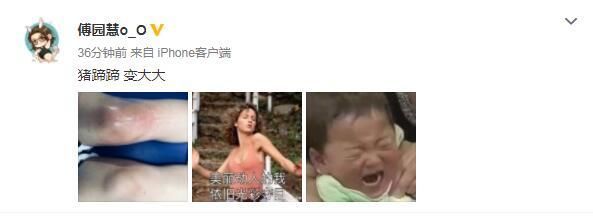 为亚运会傅园慧拼了 训练后双腿红肿调侃像猪蹄