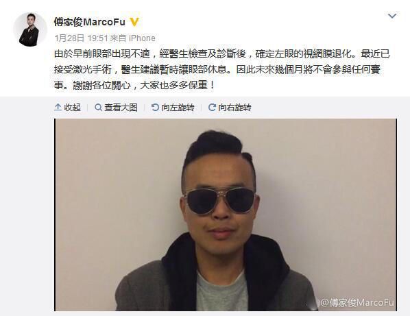 眼疾成球手职业病 傅家俊或因手术放弃世锦赛